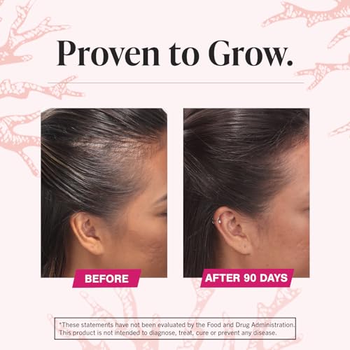 Viviscal Hair Growth Supplements for Women to Grow Thicker, Fuller Hair, Clinically Proven with Proprietary Collagen Complex, 60 Count (Pack of 1), 1 Month Supply - Image 10