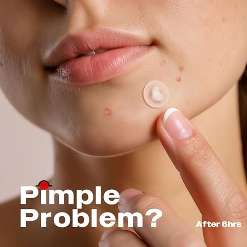 AVARELLE Pimple Patches |Hydrocolloid Acne Patches |FSA HSA Eligible Pimple Patches for Face with Tea Tree, Cica, & Calendula by ZITOUT |Vegan, Cruelty Free, Carbonfree - Image 8
