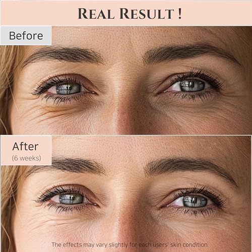 Beauty of Joseon Revive Eye Serum with Retinal Niacinamide Correction for Puffy Eye Bags Fine Lines Dark Circles Wrinkles, Korean Skin Care 30ml, 1 fl.oz - Image 8