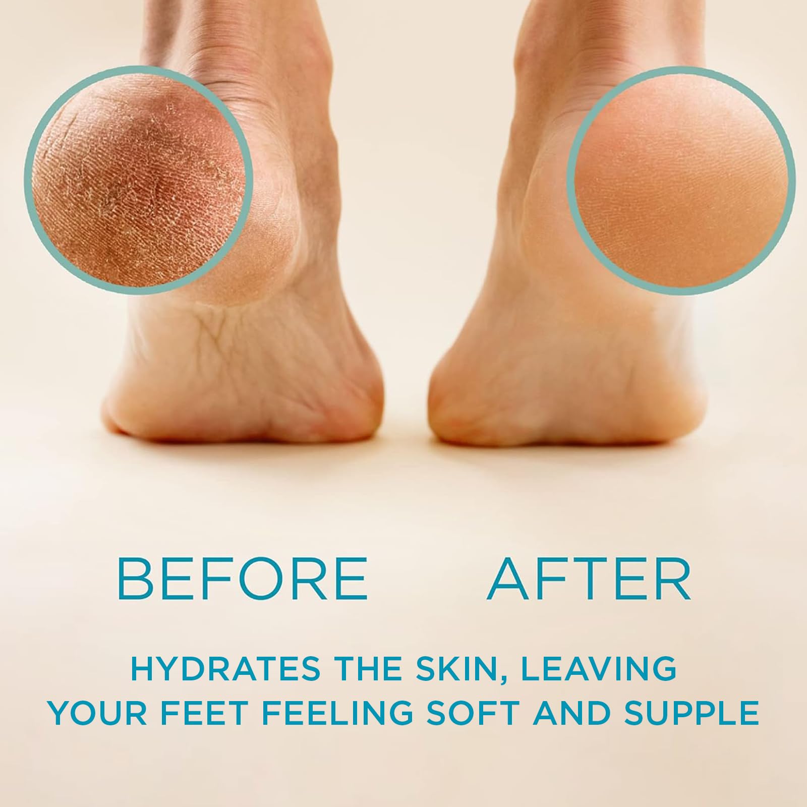 Lee Beauty Professional Callus Remover for Feet - Original, Powerful Formulation - Extra Strength Gel, Home Pedicure Foot Spa Results - Cracked & Dead Dry Skin Supplies - 8 Oz - Image 6